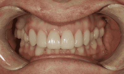 10-30-test-After-Image