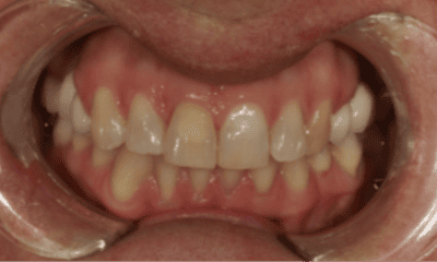 10-30-test-Before-Image